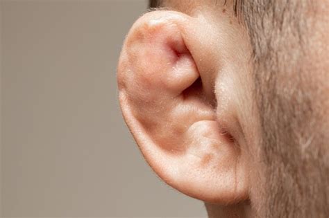 Cauliflower Ear Kondisi Telinga Menyerupai Kembang Kol Alodokter