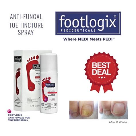 Footlogix 7t Nail Tincture Spray Anti Fungal Infection Anti Microbial