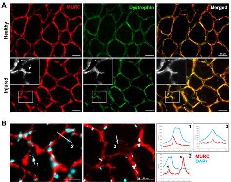 Cytoskeletal Changes In Human Skeletal Muscles Are Also Characterized