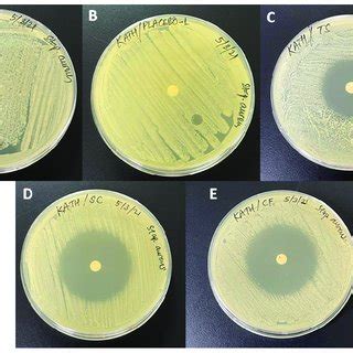 Antimicrobial test results by disc diffusion method ((A) controlled;... | Download Scientific ...