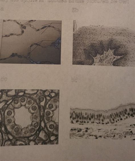 Solved Identify The Epithelial Tissues In The Pictures Chegg