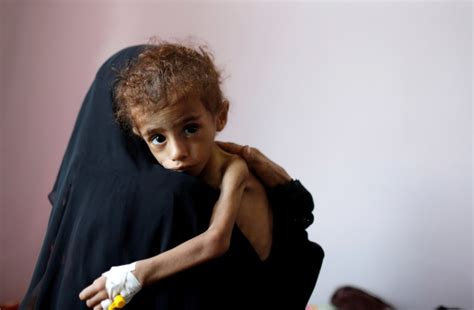 Yemen Crisis Three Stats That Reveal The Scale Of World S Worst Humanitarian Crisis