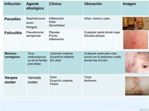 6 Infección De Piel Y Partes Blandas 1 Ppt Descarga Gratuita