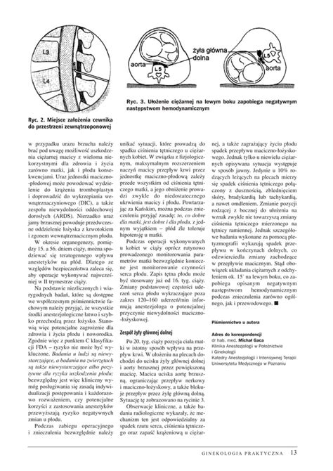 Znieczulenie Porodu Pdf