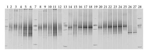 Denaturing Gradient Gel Electrophoresis Dgge Fingerprints Of