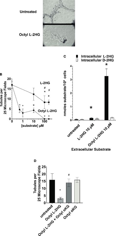 Inhibition Of Tubulogenesis By Octyl L 2hg A Representative Download Scientific Diagram