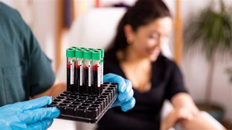 What Does Your Chloride Blood Test Tell You? - GoodRx