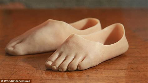 Mums Bought Me New Toes So I Can Walk Again Prosthetics For