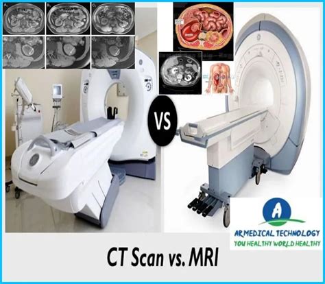 Ct Scan Vs Mri For Abdomen Best Way To Learn 24 Ar Medical Technology