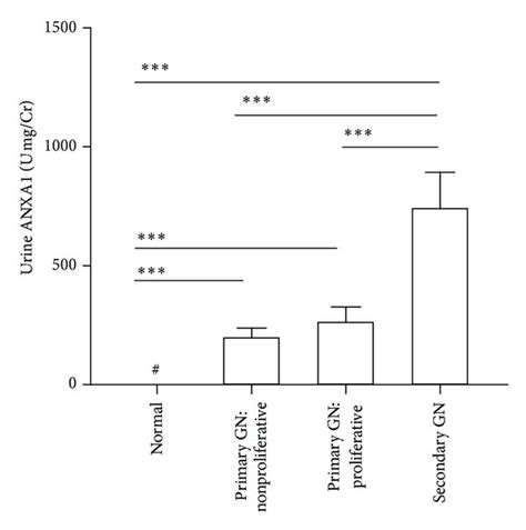 Urine Anxa Levels Correlated In Patients With Various Types Of