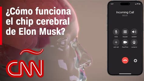 Así funciona el chip cerebral de Elon Musk YouTube