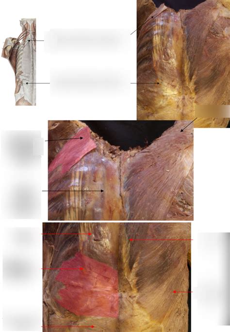 Intermediate Layer Of Extrinsic Back Muscles Diagram Quizlet