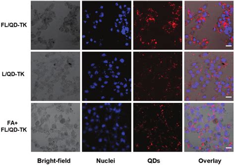 Cell Uptake Of Fl Qd Tk In Bel Cells Laser Confocal Scanning