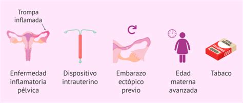 Factores De Riesgo Para El Embarazo Ect Pico