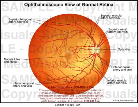 Ophthalmoscopic View of Normal Retina Medical Illustration