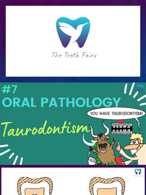 TAURODONTISM | PDF | Tooth | Health Sciences