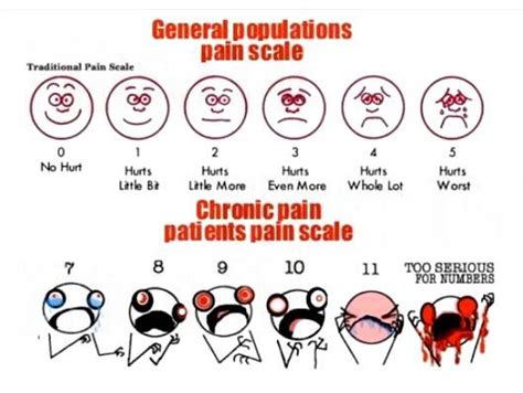 Chronic Pain Scale Chart