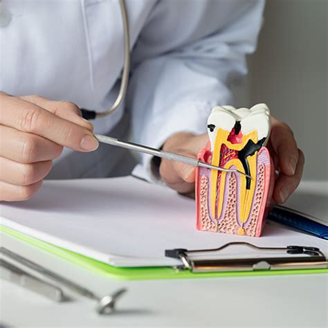 Nu Dentistry Understanding Root Canal Treatment In Spring Nu