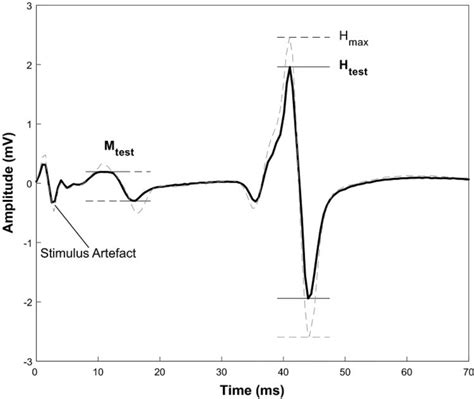 Test H Reflex Selection Test H Reflex SEMG Data Black Solid Line