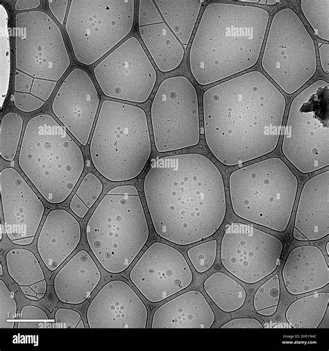 Nanopart Culas De Imagen Hechas De L Pidos Liposomas Que Contienen Un