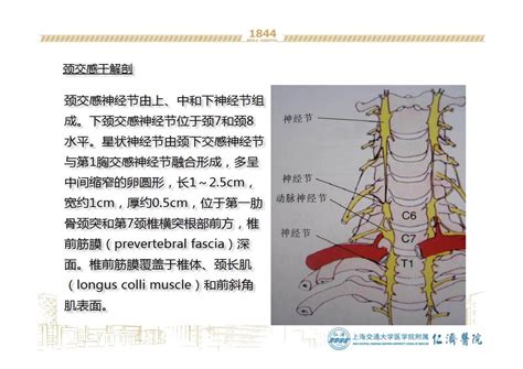 星状神经节部位图 千图网