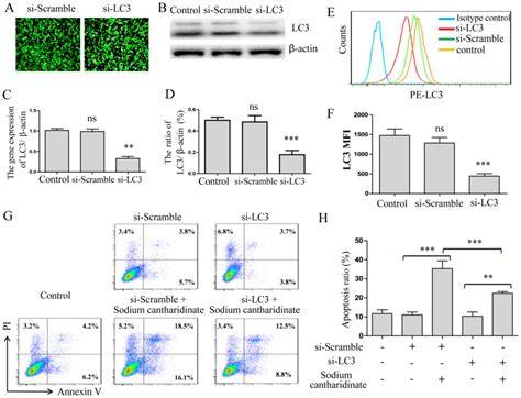 Sodium Cantharidinate Induces Hepg2 Cell Apoptosis Through Lc3