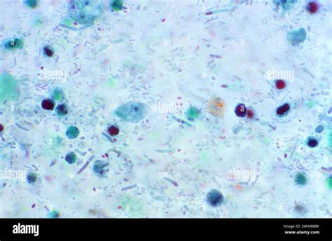 This Photomicrograph Revealed A Lightly Trichrome Stained Non Nucleated Parasitic Trophozoite