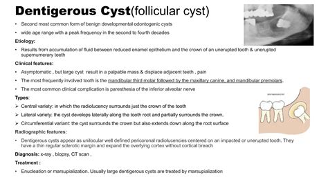 Classification And Management Odontogenic Cysts Of Oral Cavity PPT