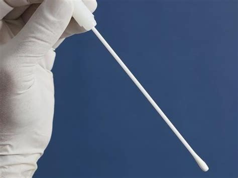 Cancer Currents Post On Anal Cancer Screening Features DCEG NCI