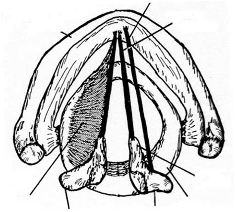 COMD 3100 Ch 3 Larynx Sup View Diagram Diagram Quizlet