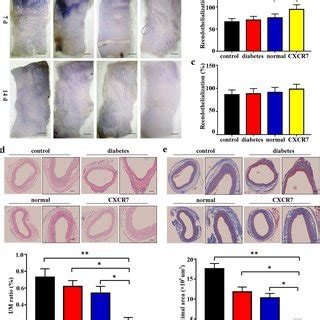 Upregulating Cxcr Expression Activated The Akt Associated Keap Nrf