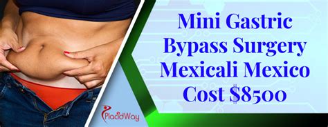 Best Mini Gastric Bypass Package Mexicali Mexico