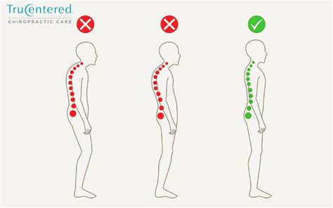 Why Good Posture Matters Trucentered Chiropractic Care Chiropractor