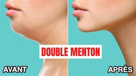 Comment Perdre Son Double Menton Astuces Faciles Et Rapides