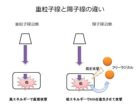 重粒子線と陽子線治療の違いは？保険適応なの？