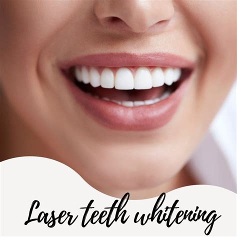 Benefits And Drawbacks Of Laser Teeth Whitening