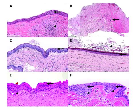 A Representative Histological Photomics Of Developmental OCs A DC Is