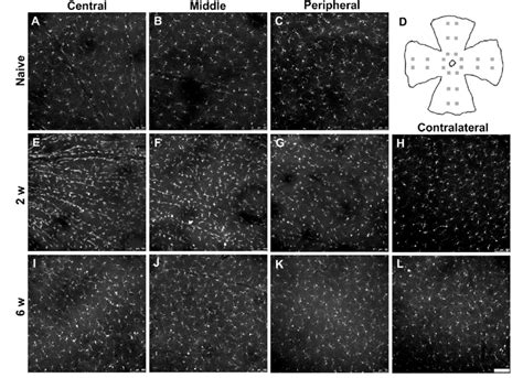 Post Axotomy Changes In Microglial Density In The Gcl Characteristics