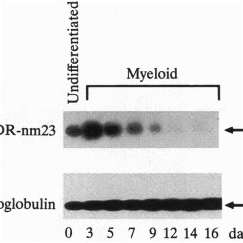 Kinetics Of DR Nm23 MRNA Expression During Myeloid Differentiation Of