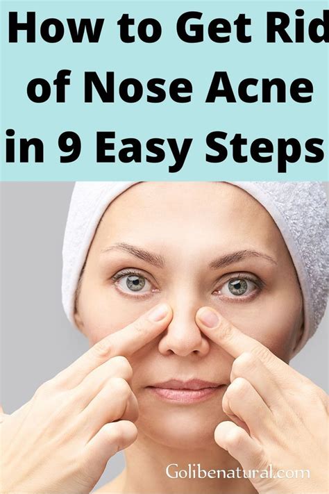 9 Easy Steps To Clear Nose Acne