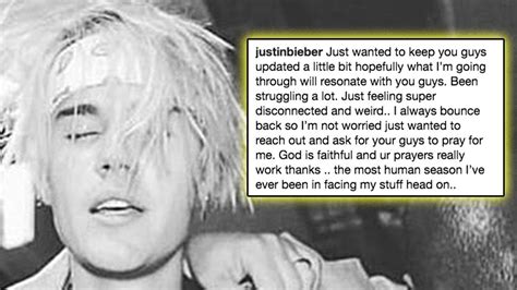 Justin Bieber Admits To Struggling And Opens Up About Mental Health On