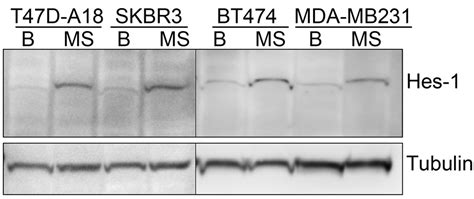 Figure 3 Inhibition Of Notch Signaling Reduces The Stem Like