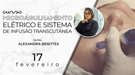 Curso De Microagulhamento El Trico E Sistema De Infus O Alexandra