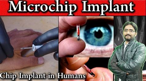 Microchip Implant In Humans The Future Of Identity RFID Chip