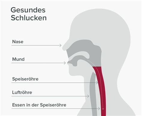 Wenn Kauen Und Schlucken Schwerfallen Ern Hrung Bei Schluckst Rungen