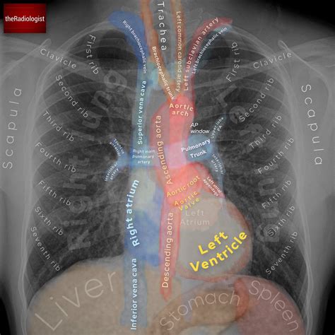 Anatomy Of Chest X Ray : Normal Chest Xray Stock Photo Download Image ...