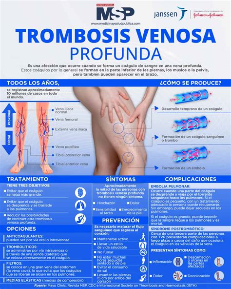 Trombosis Venosa Profunda Infograf A