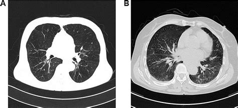 Representative Cases Showing Sex Differences On Computed Tomography