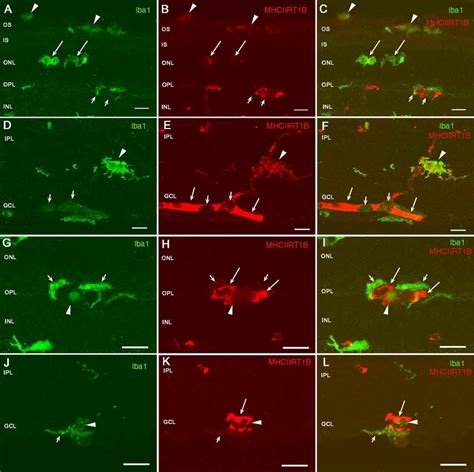 Distribution And Morphology Of Microglial Cells In The Retinas Of