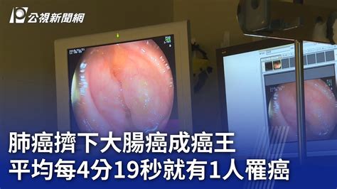 肺癌擠下大腸癌成癌王 平均每4分19秒就有1人罹癌｜20231110 公視晚間新聞 Youtube